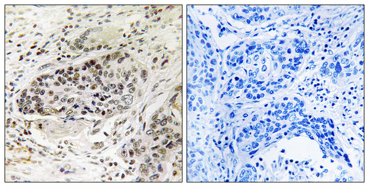 X11β Rabbit Polyclonal Antibody
