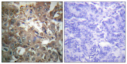 XPA Rabbit Polyclonal Antibody