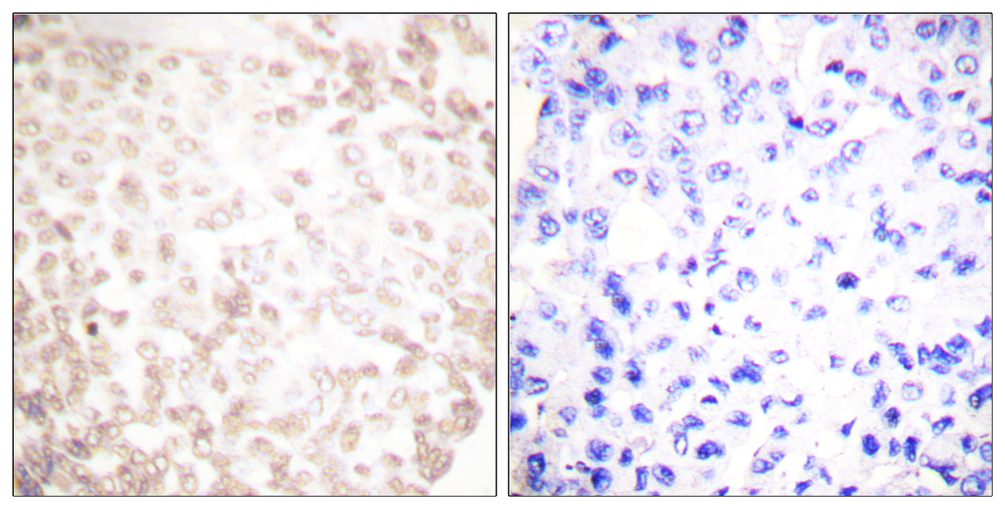 XRCC1 Rabbit Polyclonal Antibody