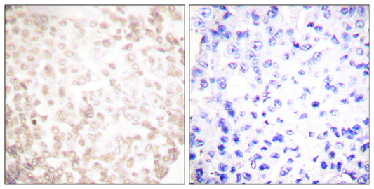XRCC1 Rabbit Polyclonal Antibody