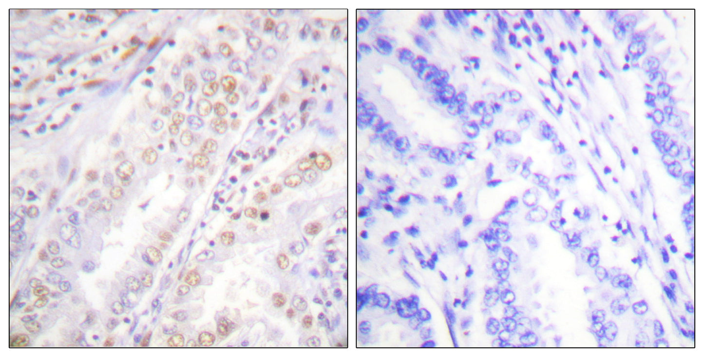 XRCC2 Rabbit Polyclonal Antibody