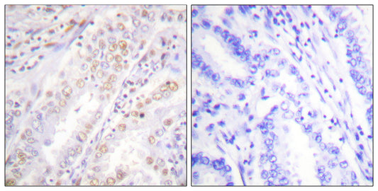 XRCC2 Rabbit Polyclonal Antibody