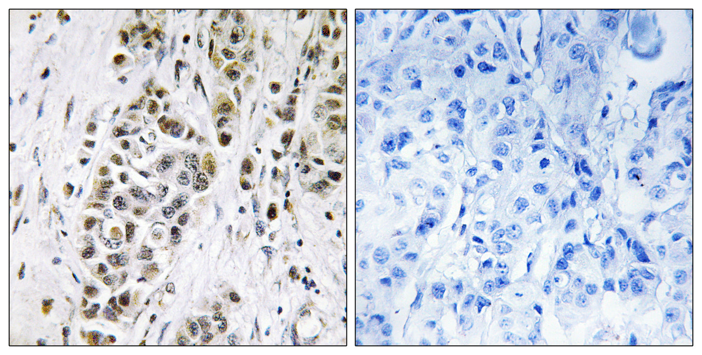 XRN2 Rabbit Polyclonal Antibody
