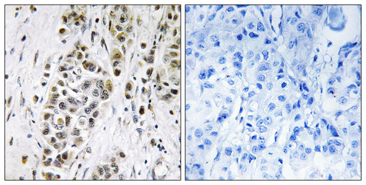 XRN2 Rabbit Polyclonal Antibody