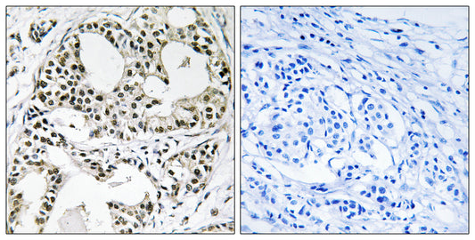 YEATS2 Rabbit Polyclonal Antibody