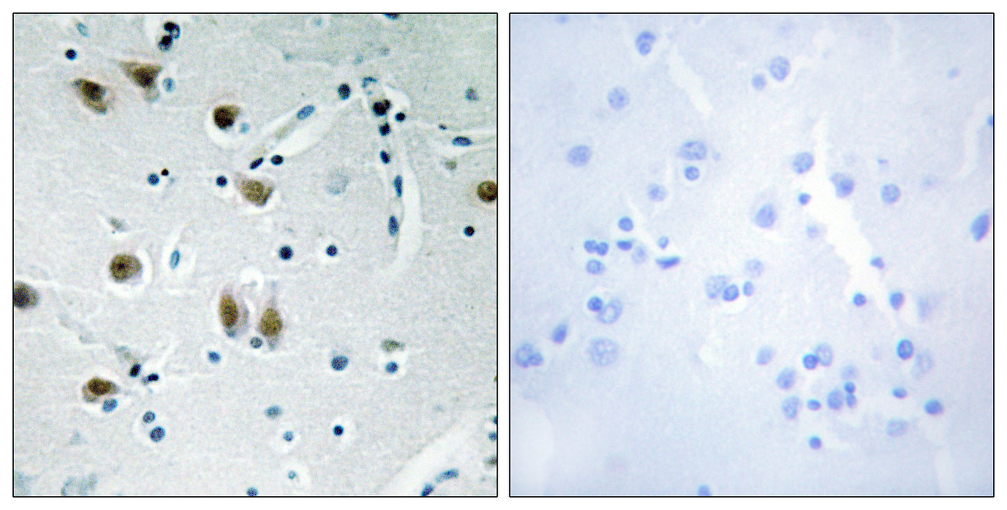 ZBP-89 Rabbit Polyclonal Antibody