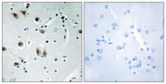ZBP-89 Rabbit Polyclonal Antibody