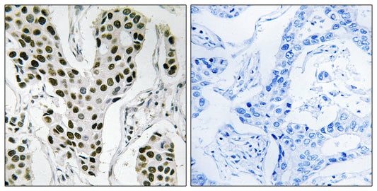 ZC3H4 Rabbit Polyclonal Antibody