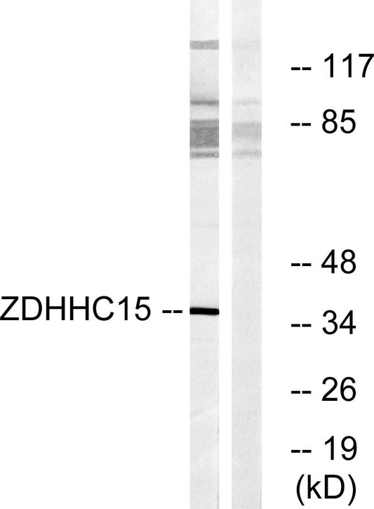 ZDHHC15 Rabbit Polyclonal Antibody