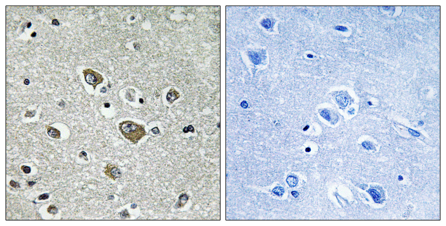 ZDHHC9 Rabbit Polyclonal Antibody