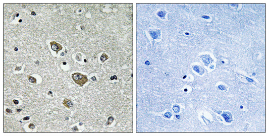 ZDHHC9 Rabbit Polyclonal Antibody