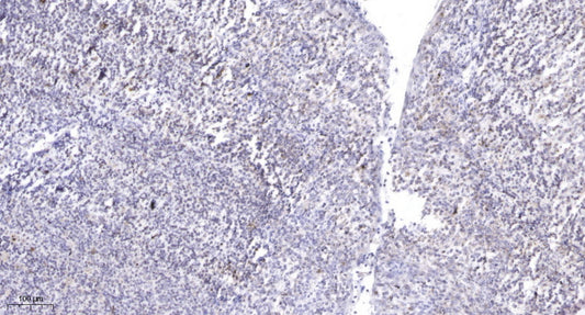 ZFHX2 Rabbit Polyclonal Antibody