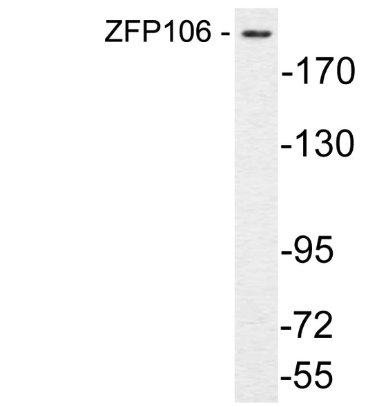 ZFP106 Rabbit Polyclonal Antibody