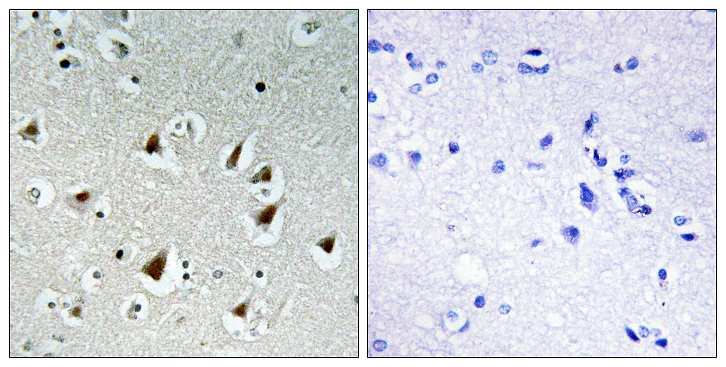 ZHX2 Rabbit Polyclonal Antibody