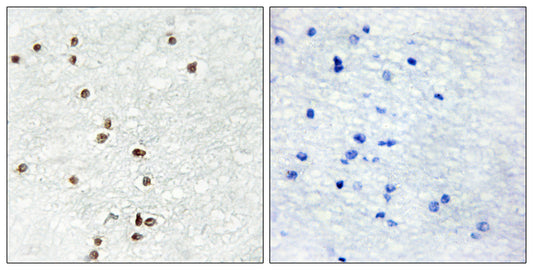 Zic1/2/3 Rabbit Polyclonal Antibody