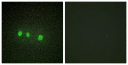 Zic1/2/3/4/5 Rabbit Polyclonal Antibody