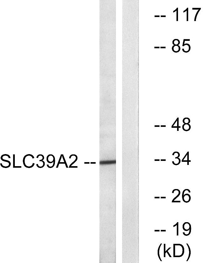 ZIP2 Rabbit Polyclonal Antibody