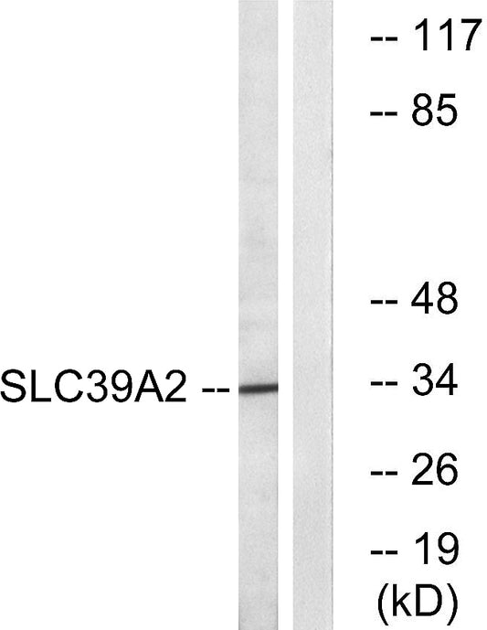 ZIP2 Rabbit Polyclonal Antibody