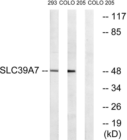 ZIP7 Rabbit Polyclonal Antibody