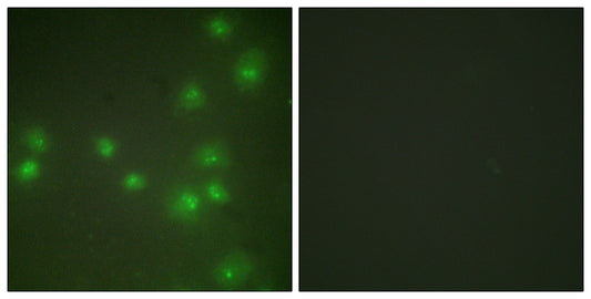 ZIS Rabbit Polyclonal Antibody