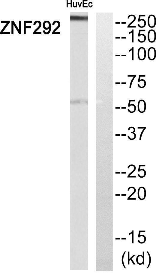 ZN-16 Rabbit Polyclonal Antibody