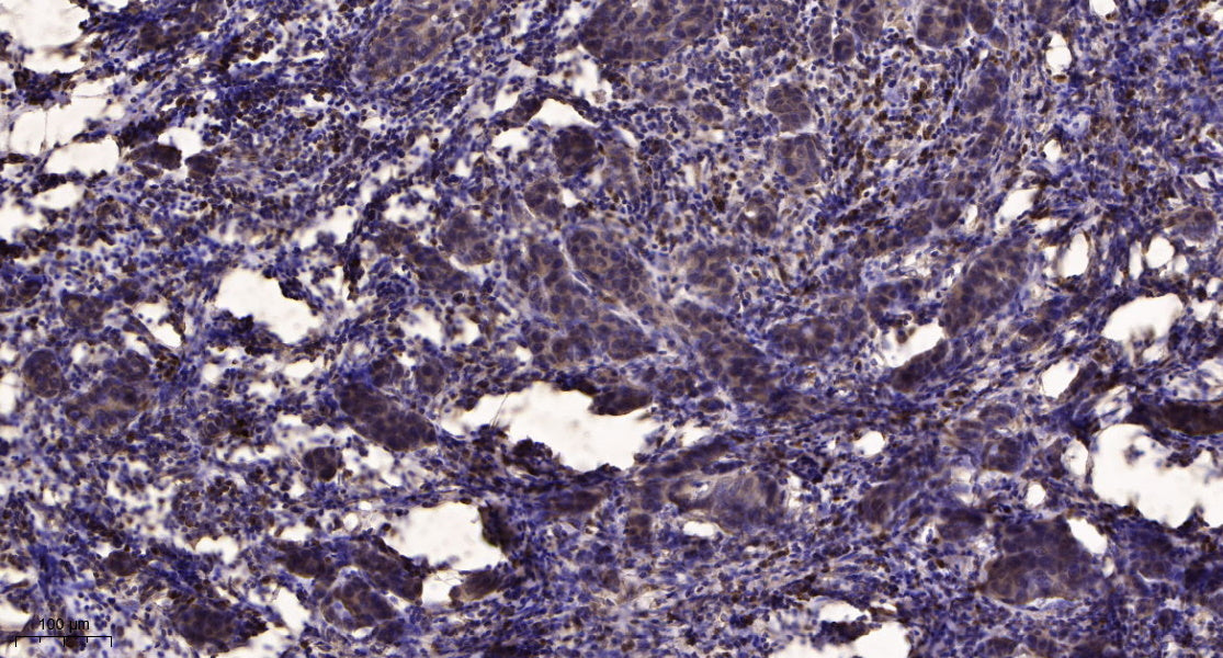 ZN462 Rabbit Polyclonal Antibody