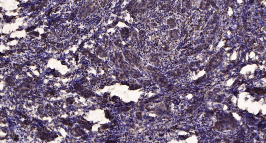 ZN462 Rabbit Polyclonal Antibody