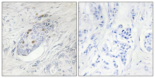 ZNF232 Rabbit Polyclonal Antibody