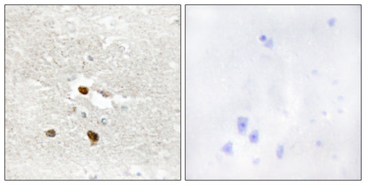 ZNF287 Rabbit Polyclonal Antibody
