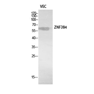 ZNF384 Rabbit Polyclonal Antibody