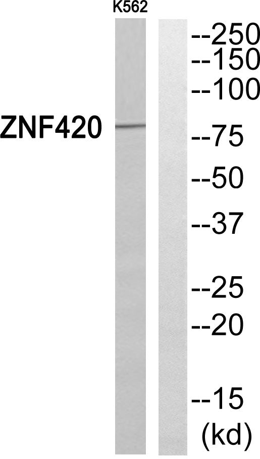 ZNF420 Rabbit Polyclonal Antibody