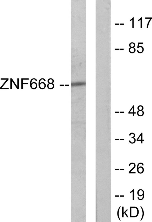 ZNF668 Rabbit Polyclonal Antibody