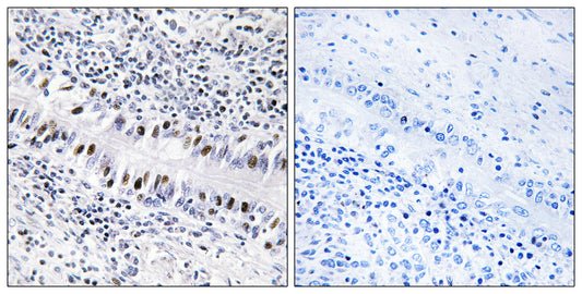 ZNF76 Rabbit Polyclonal Antibody