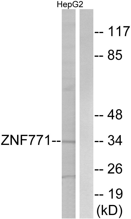 ZNF771 Rabbit Polyclonal Antibody
