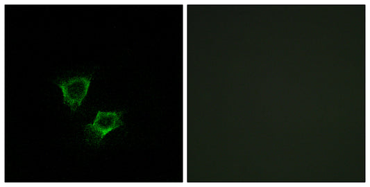 ZNRF2 Rabbit Polyclonal Antibody