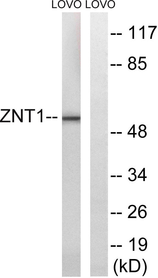 ZnT-1 Rabbit Polyclonal Antibody