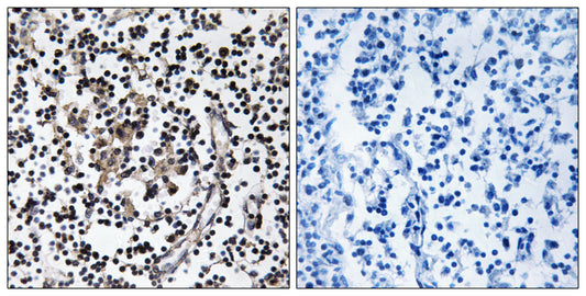 ZnT-4 Rabbit Polyclonal Antibody