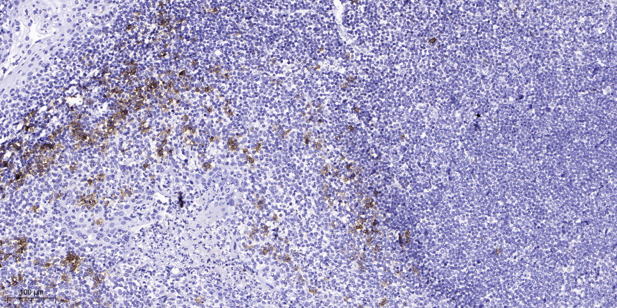 ZP2 Rabbit Polyclonal Antibody