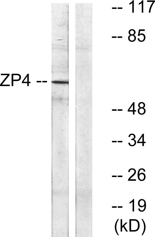 ZP4 Rabbit Polyclonal Antibody