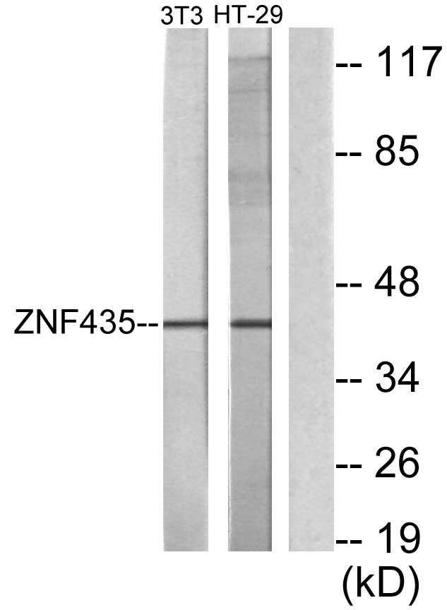 ZSCAN16 Rabbit Polyclonal Antibody