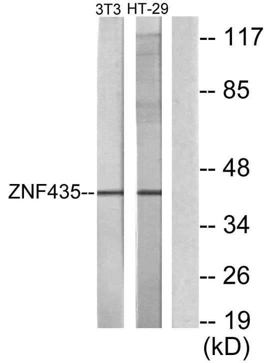 ZSCAN16 Rabbit Polyclonal Antibody