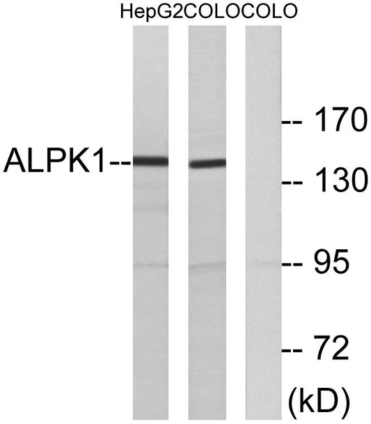 α-protein Kinase 1 Rabbit Polyclonal Antibody