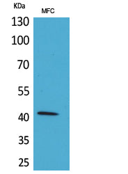 α-SMA Rabbit Polyclonal Antibody