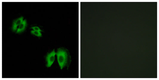 β-1,3-Gal-T2 Rabbit Polyclonal Antibody
