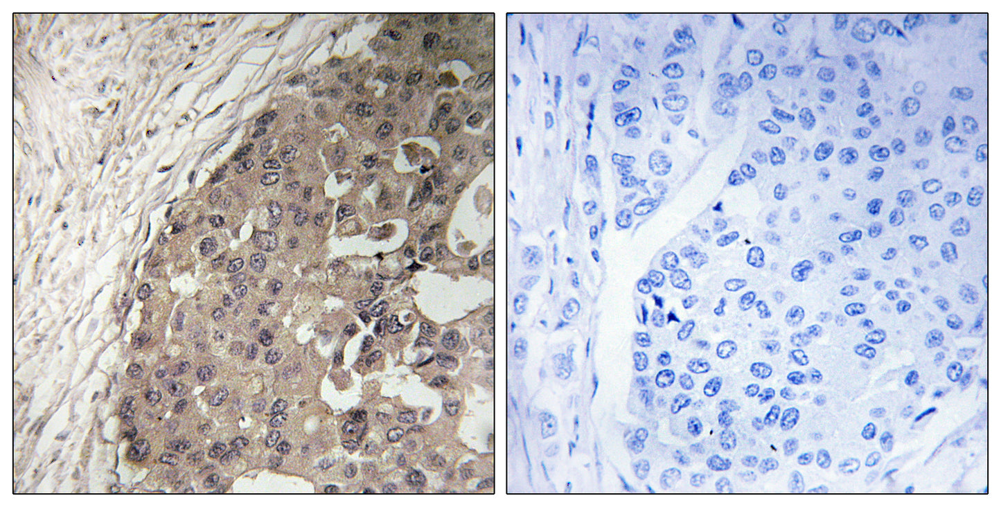 β-1,4-GalNAc-T Rabbit Polyclonal Antibody