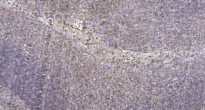β-1,4-Gal-T1 Rabbit Polyclonal Antibody