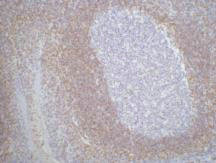 BCL2 Monoclonal Antibody