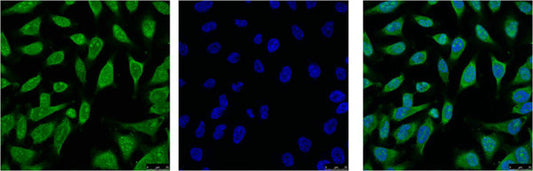 HSPA1L Monoclonal Antibody