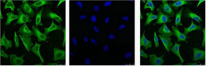 EGFR Monoclonal Antibody