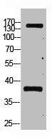 PTPRC Monoclonal Antibody